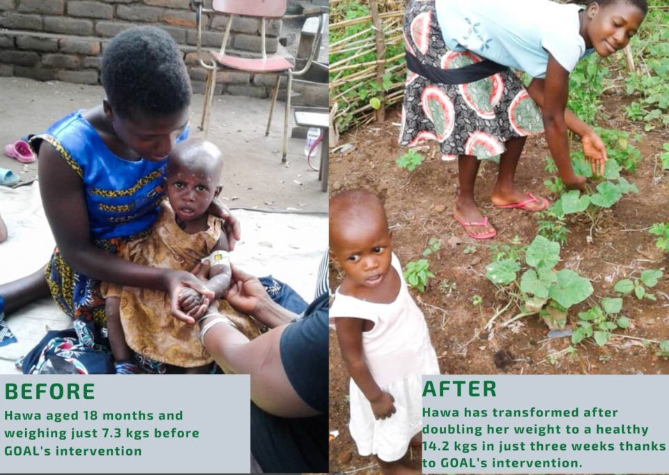 GOAL and Irish Aid combat infant malnutrition in Malawi - GOAL Global